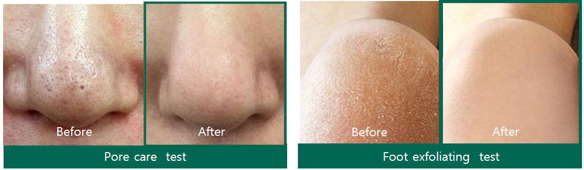 AHA-BHA-PHA 30 DAYS MIRACLE CLEANSING BAR