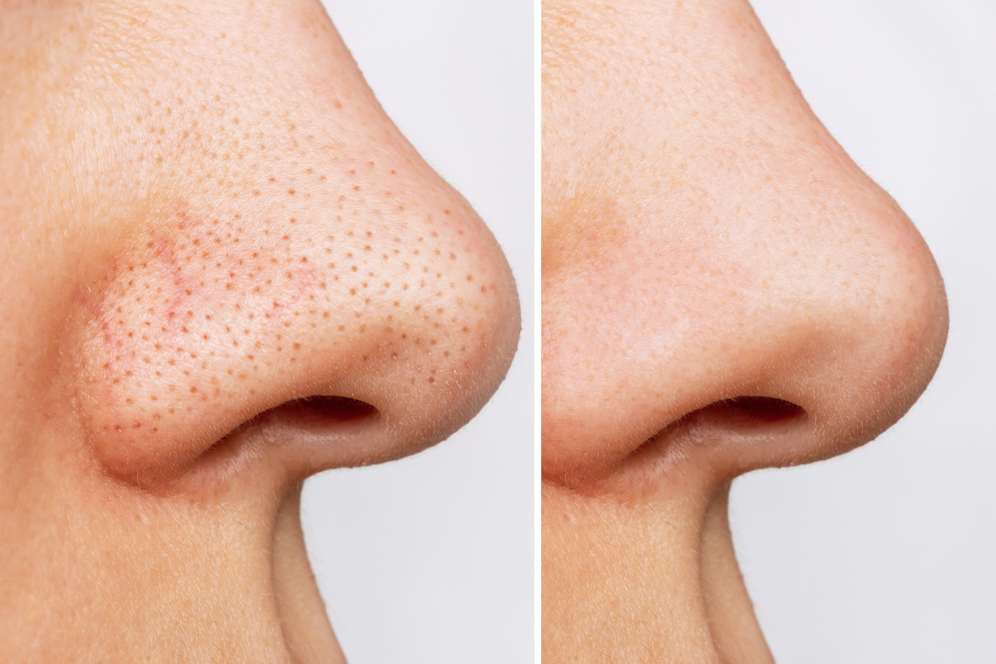 Heartleaf Pore Control Cleansing Oil